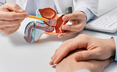NHS recommends prostate artery embolization