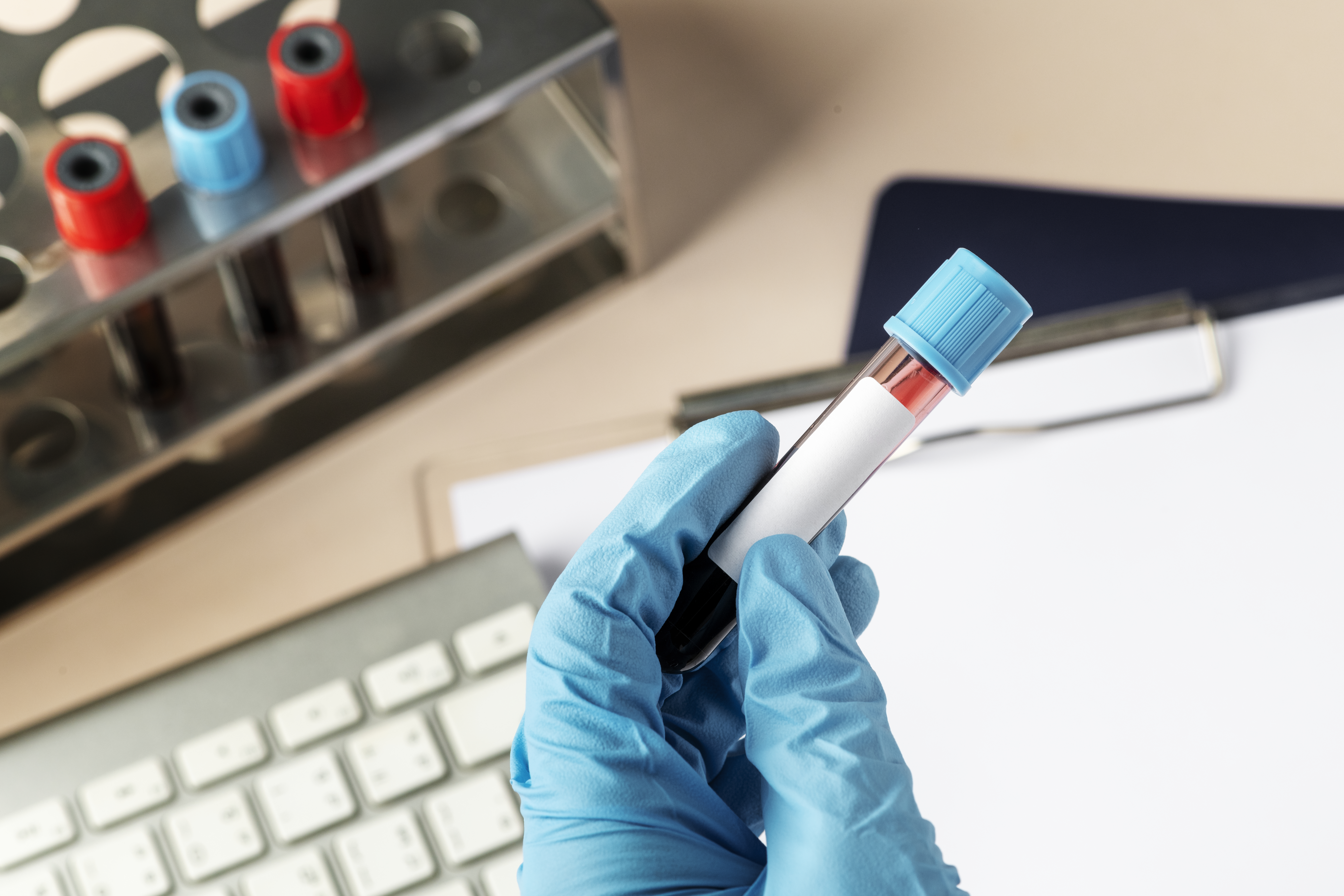 Hypertrophie de la prostate et PSA